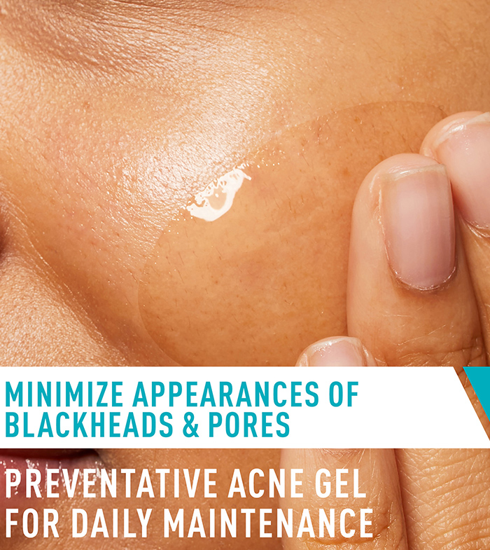 acne-control-gel-apply-desktop-700x785-v1.jpg