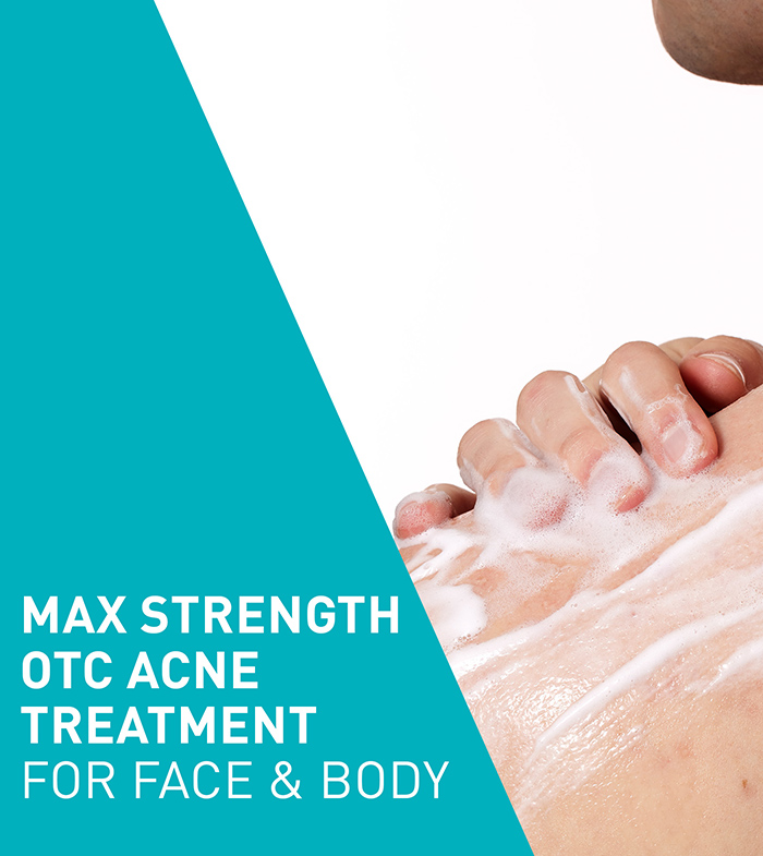 bpo10-treatment-desktop-700x785-v1.jpg