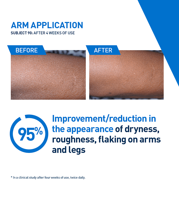 iml_700x785_arm-application_v1-min.png