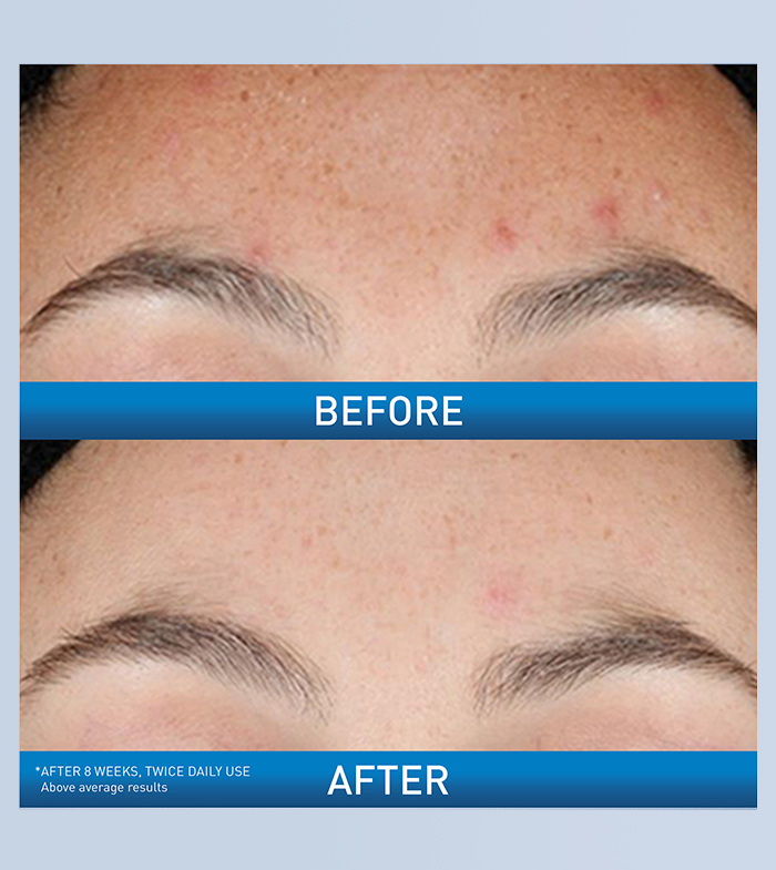 retinol-ba-desktop-700x785-v1.jpg